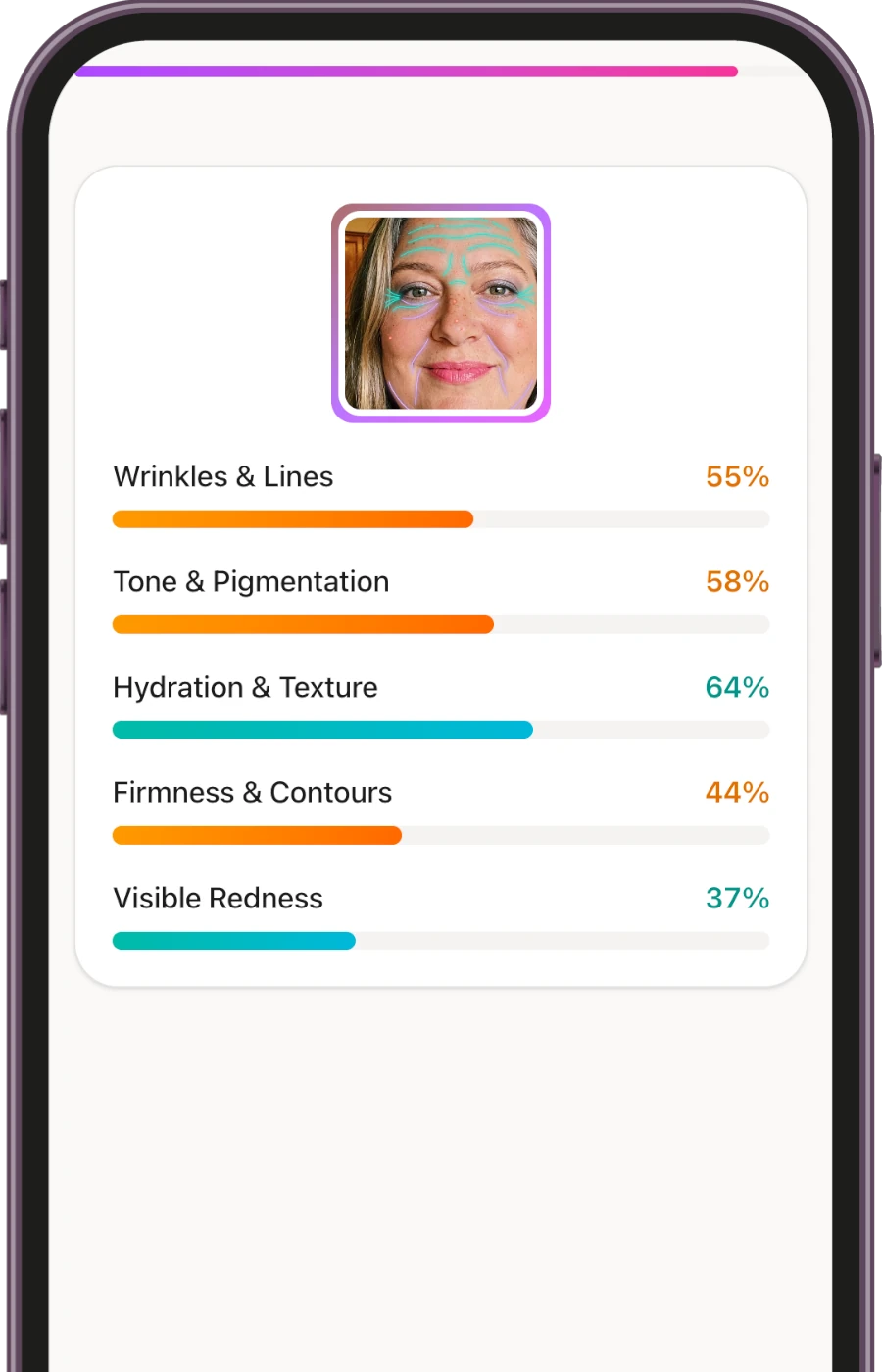 Skin Analysis